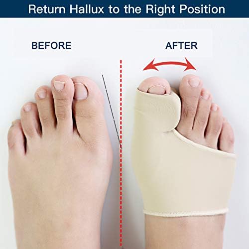 Bunion Corrector Medical-Grade Gel Sleeve & Toe Spacer