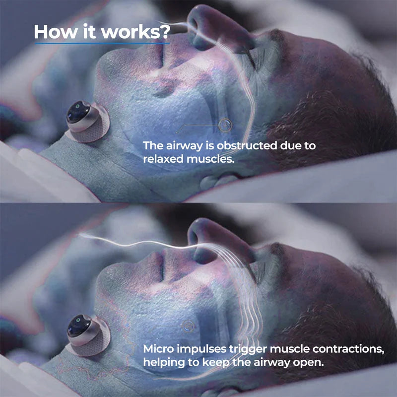 Chin Support Clip Soft Adjustable Sleep Aid