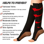 Compression Socks Zip-Up Graduated 20–30 mmHg Open-Toe Style