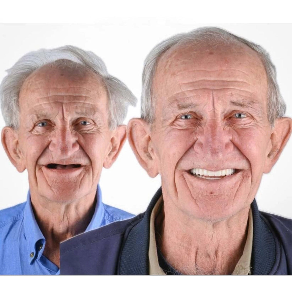 Full Denture Set Upper & Lower Flexible Cushion Grip