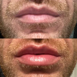Lip Plumper Serum Cooling Tingle Hydrating Formula