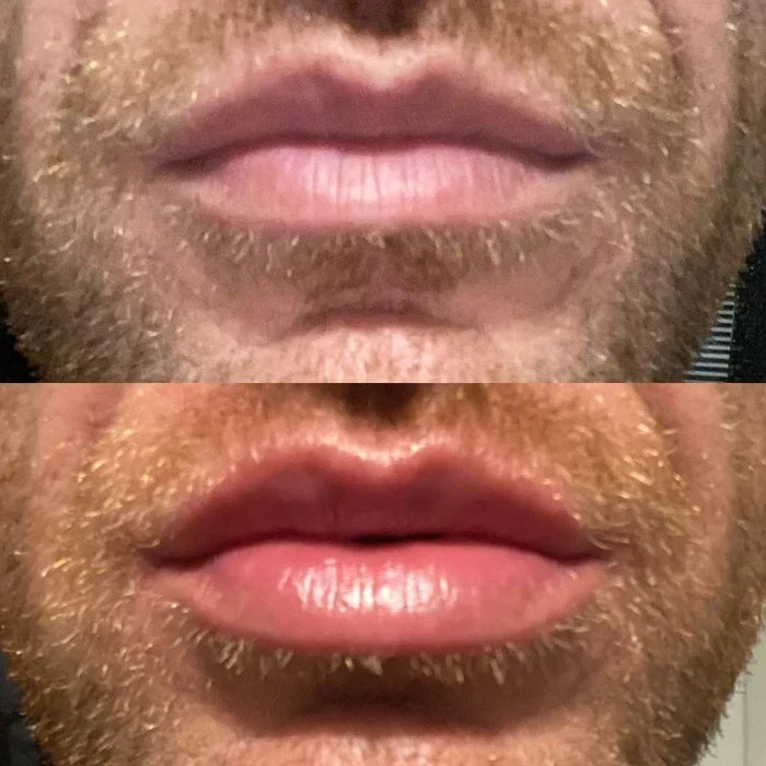 Lip Plumper Serum Cooling Tingle Hydrating Formula