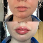 Lip Plumper Serum Cooling Tingle Hydrating Formula