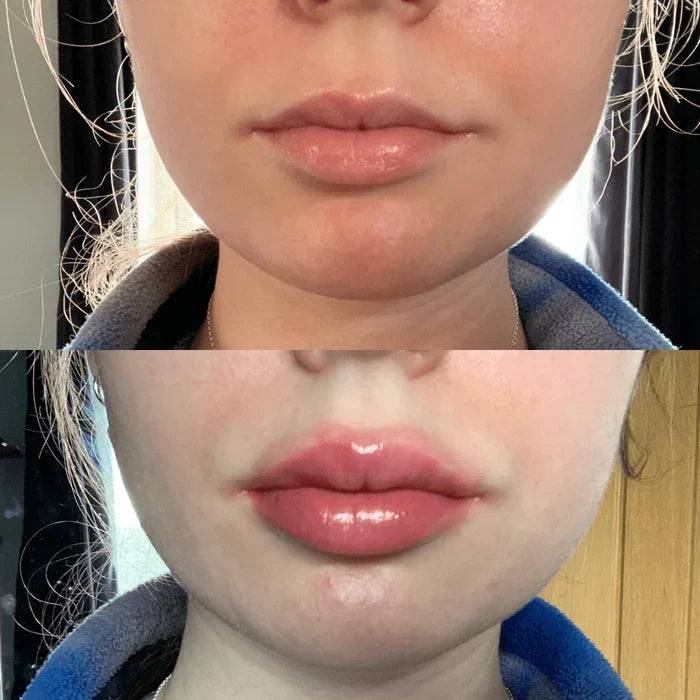 Lip Plumper Serum Cooling Tingle Hydrating Formula