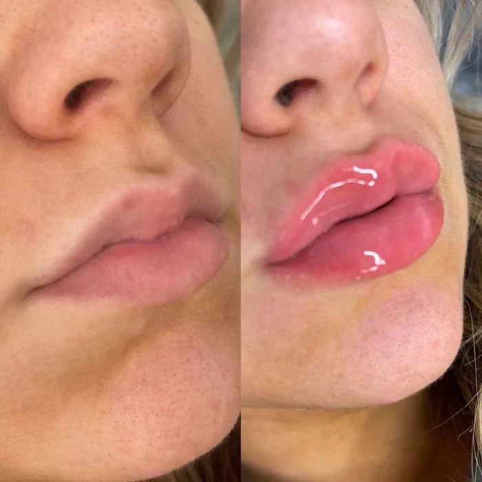 Lip Plumper Serum Cooling Tingle Hydrating Formula