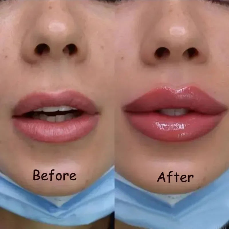 Lip Plumper Serum Cooling Tingle Hydrating Formula