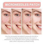 Pimple Patches Hydrocolloid Invisible Ultra-Thin Multiple Sizes