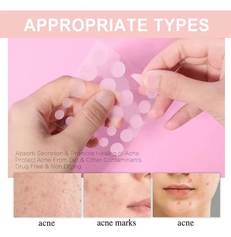 Pimple Patches Hydrocolloid Invisible Ultra-Thin Multiple Sizes