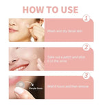 Pimple Patches Hydrocolloid Invisible Ultra-Thin Multiple Sizes