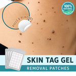 Skin Tag Removal Patches Gentle Non-Invasive Discreet Wear