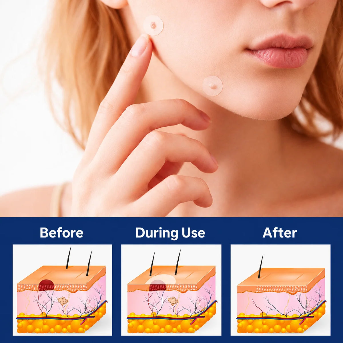 Skin Tag Removal Patches Gentle Non-Invasive Discreet Wear