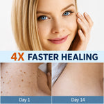 Skin Tag Removal Patches Gentle Non-Invasive Discreet Wear