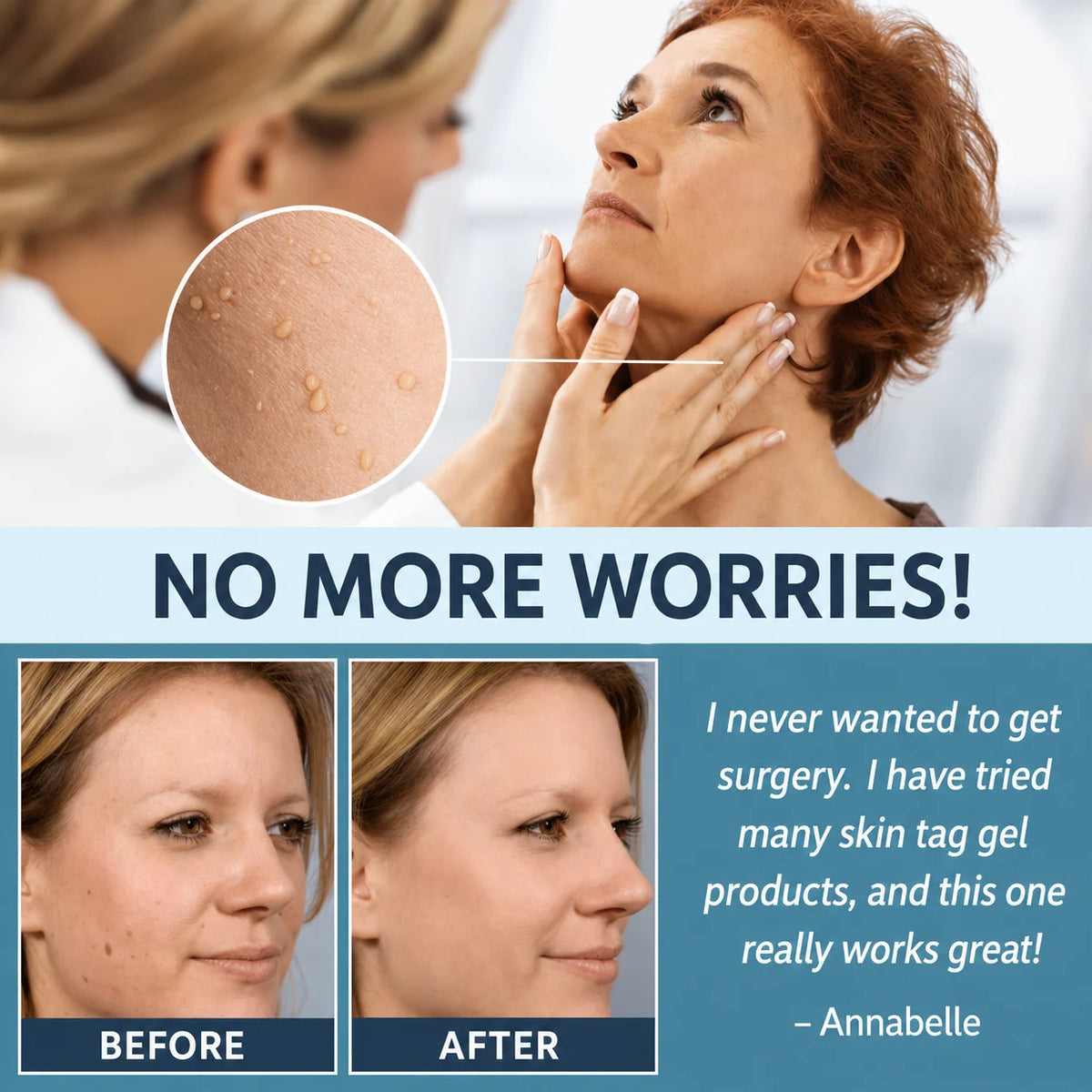 Skin Tag Removal Patches Gentle Non-Invasive Discreet Wear