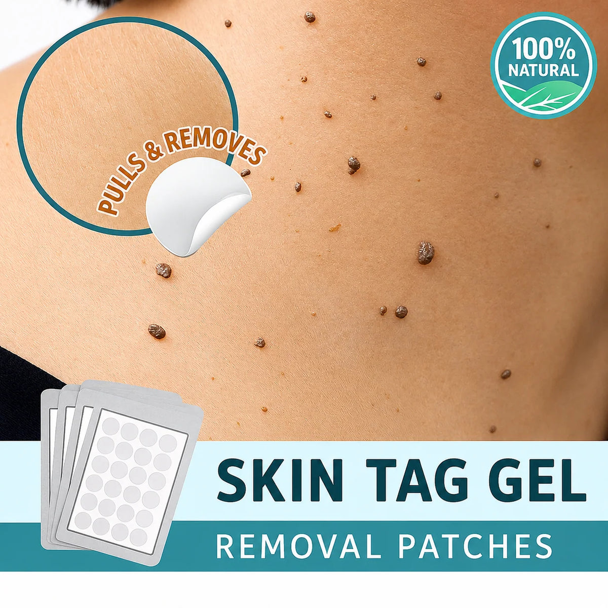 Skin Tag Removal Patches Non-Invasive Discreet Wear