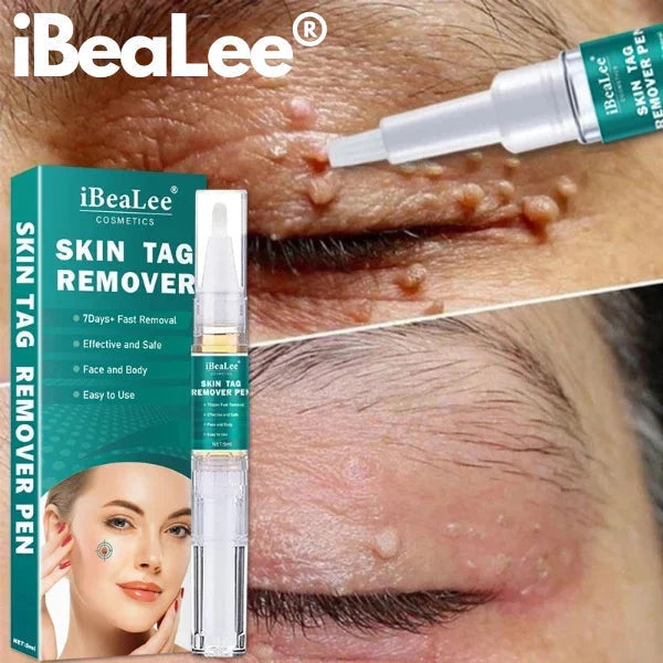 Spot Treatment Skin Tags & Dark Spots Gentle 20 Ml