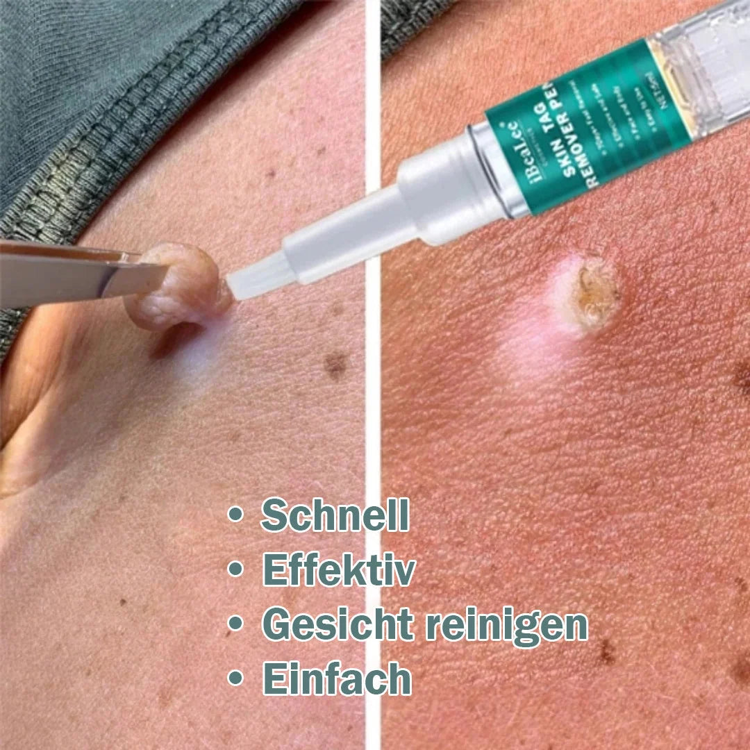 Spot Treatment Skin Tags & Dark Spots Gentle 20 Ml