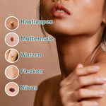 Spot Treatment Skin Tags & Dark Spots Gentle 20 Ml