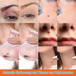 Spot Treatment Skin Tags & Dark Spots Gentle 20 Ml