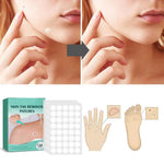 Wart Removal Patches Hydrocolloid Transparent Set of 120