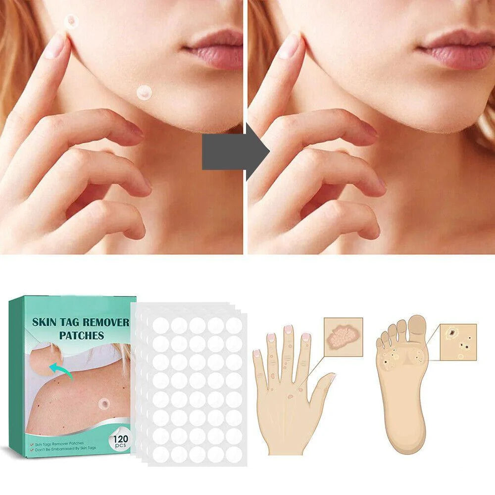 Wart Removal Patches Hydrocolloid Transparent Set of 120