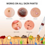Wart & Skin Tag Remover Plant-Based Precision Applicator