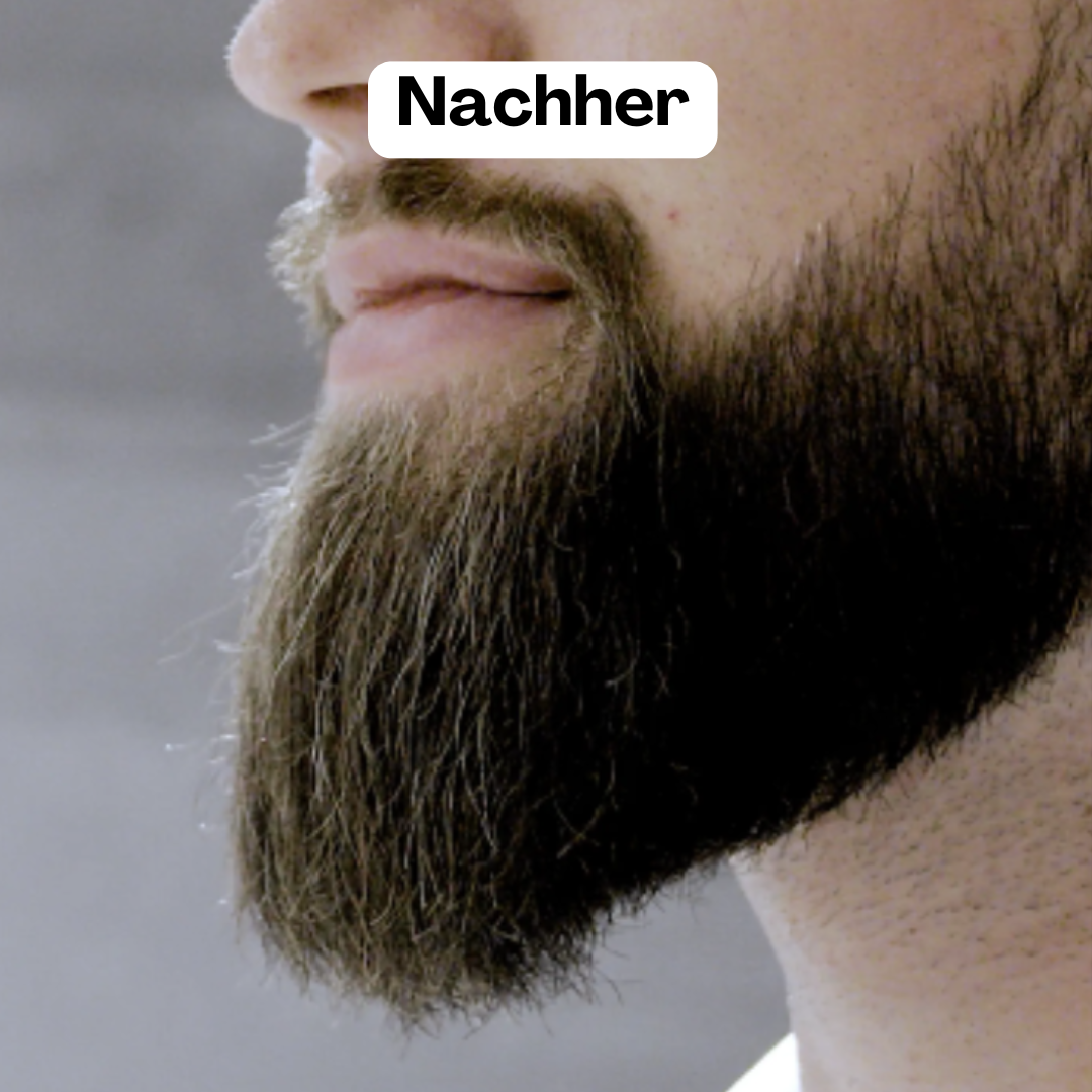 Eleganter Bartstyler | Kabelloses Gerät für einen makellosen Look