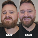 Eleganter Bartstyler | Kabelloses Gerät für einen makellosen Look