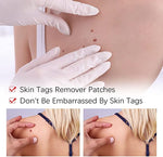 Wart Remover | Precision Pen for Blemishes | Herbal Formula