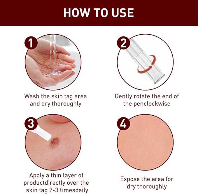 Wart Remover | Precision Pen for Blemishes | Herbal Formula