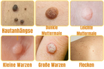 Skincare product against skin impurities | Painless application | Bee sting formula