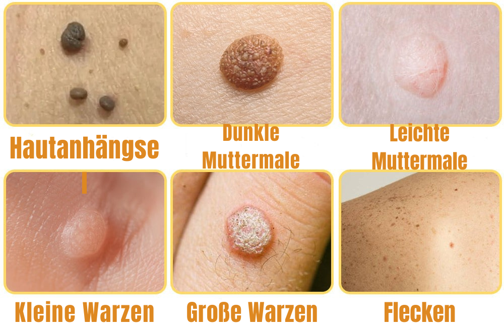 Skincare product against skin impurities | Painless application | Bee sting formula