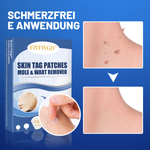 Skin-Friendly Remover Patches | Gentle Solution for Blemishes