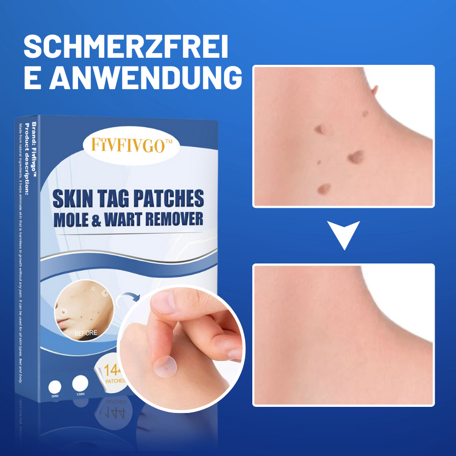 Skin-Friendly Remover Patches | Gentle Solution for Blemishes