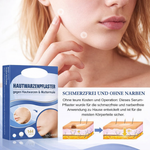 Skin-Friendly Remover Patches | Gentle Solution for Blemishes