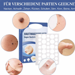 Skin-Friendly Remover Patches | Gentle Solution for Blemishes