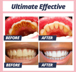 Brighter Teeth | Stain Removal Toothpaste | Gentle Cleaning with Baking Soda