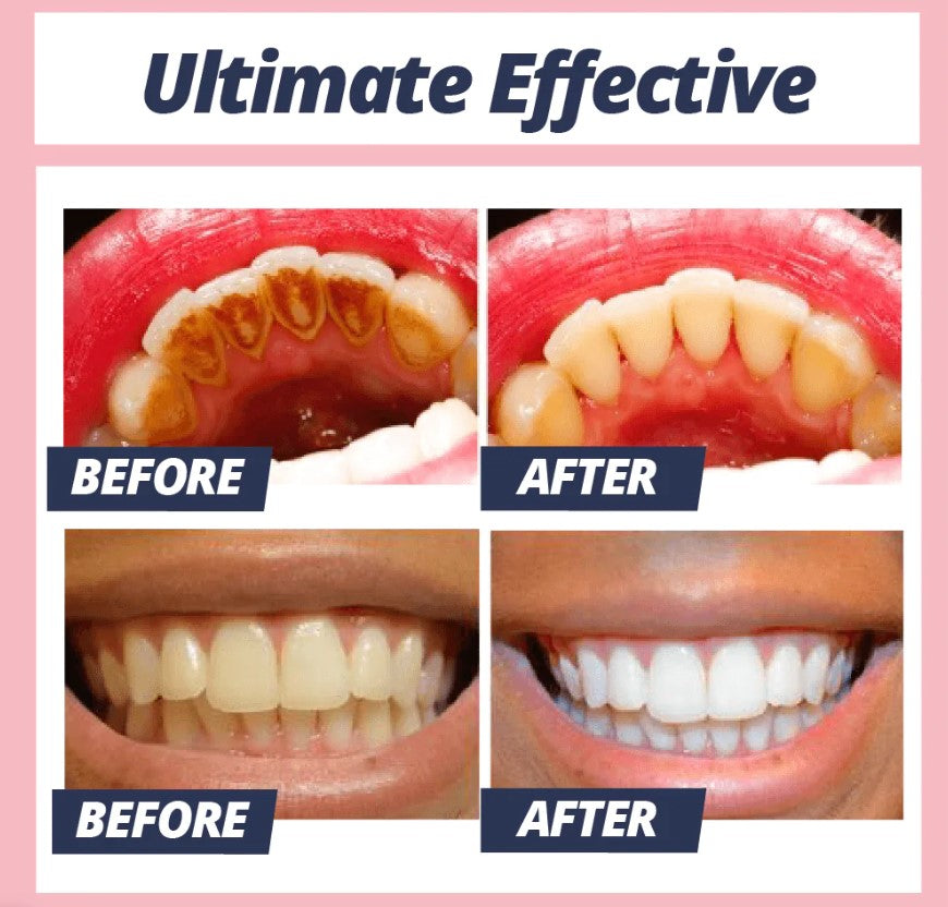 Brighter Teeth | Stain Removal Toothpaste | Gentle Cleaning with Baking Soda