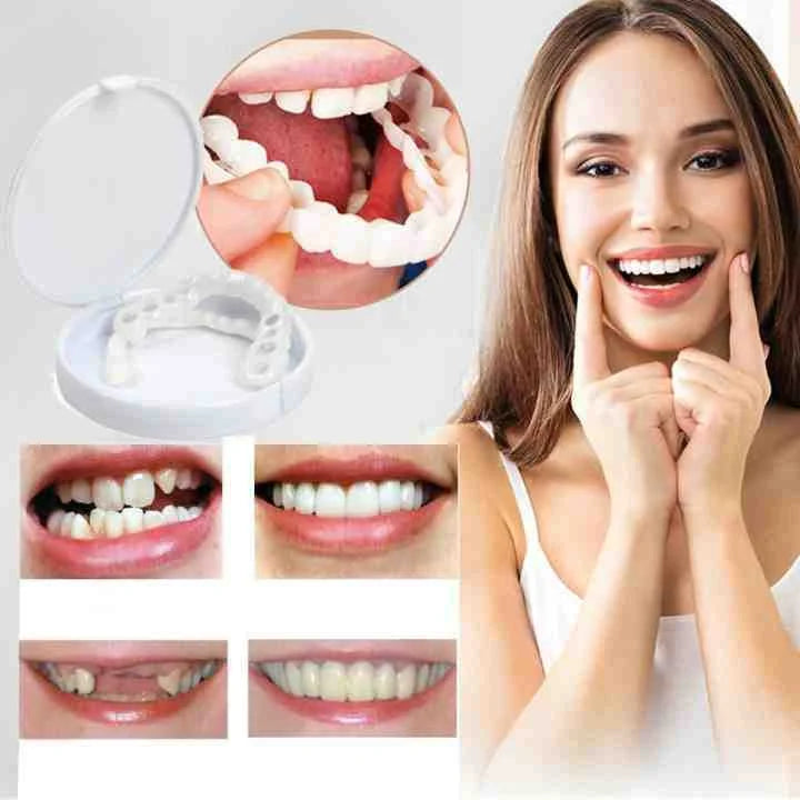 Sofortige Zahnprothese | Lächeln ohne Kleber | Flexibler Sitz | SmileEase