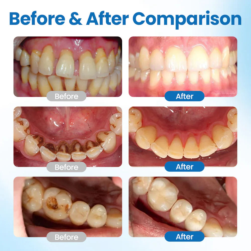 Tooth Protection Serum for Stronger Enamel and Less Sensitivity