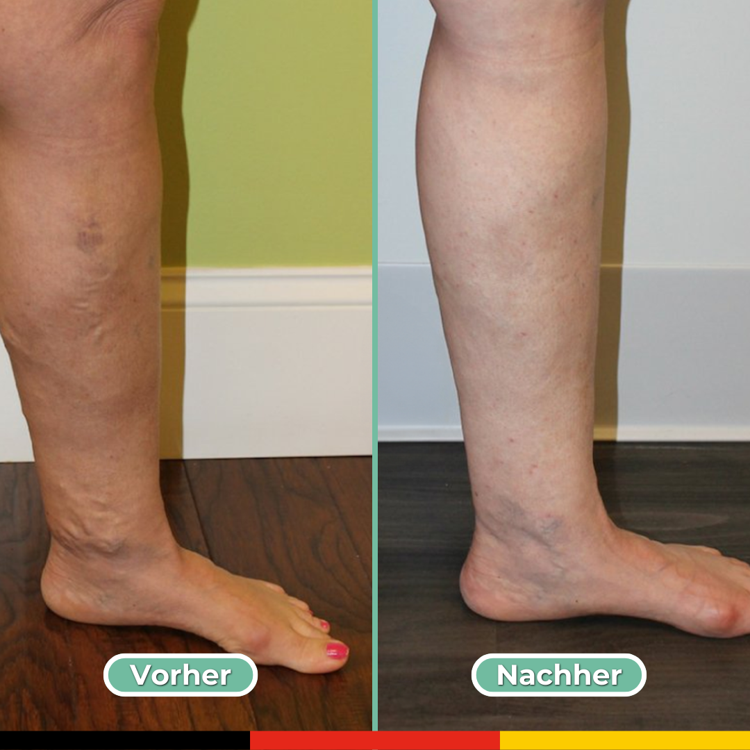 Multifunctional Leg Pain Reliever | Vitaris