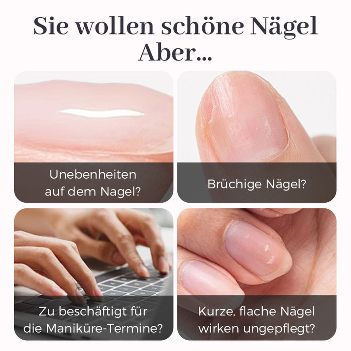 All-in-One Nagel Grundierungsgel | Ideal für Anfänger und Profis