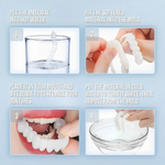 Full Veneer Set – Cosmetic Covers for Upper and Lower Jaw