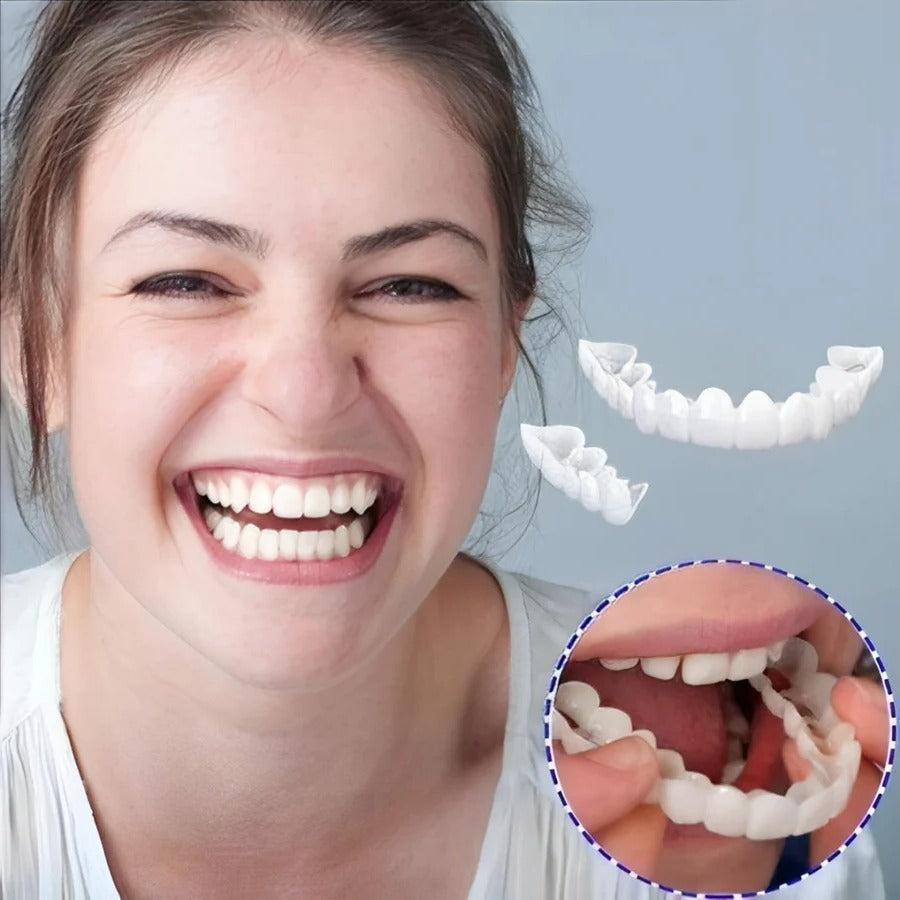 Full Veneer Set – Cosmetic Covers for Upper and Lower Jaw