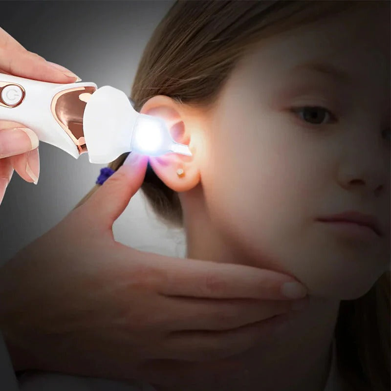 5-in-1 Electric Earwax Remover