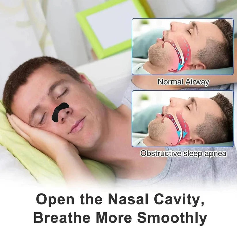 Nasal strips for better breathing support at night