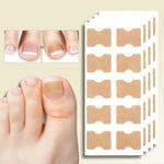 Adhesive toenail support strips for curved nails and daily care