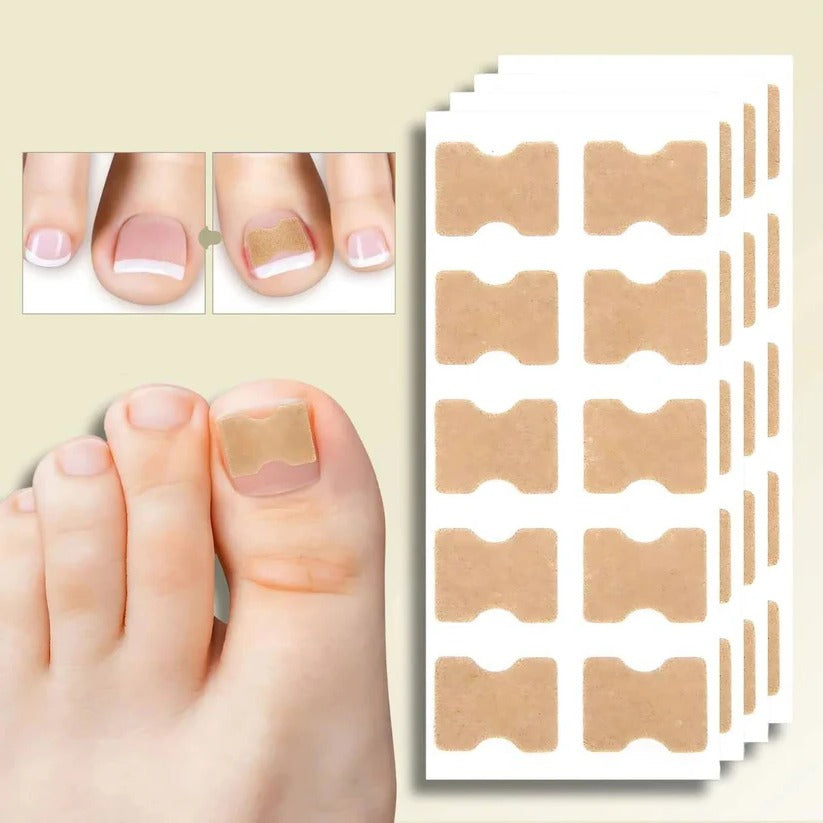 Adhesive toenail support strips for curved nails and daily care