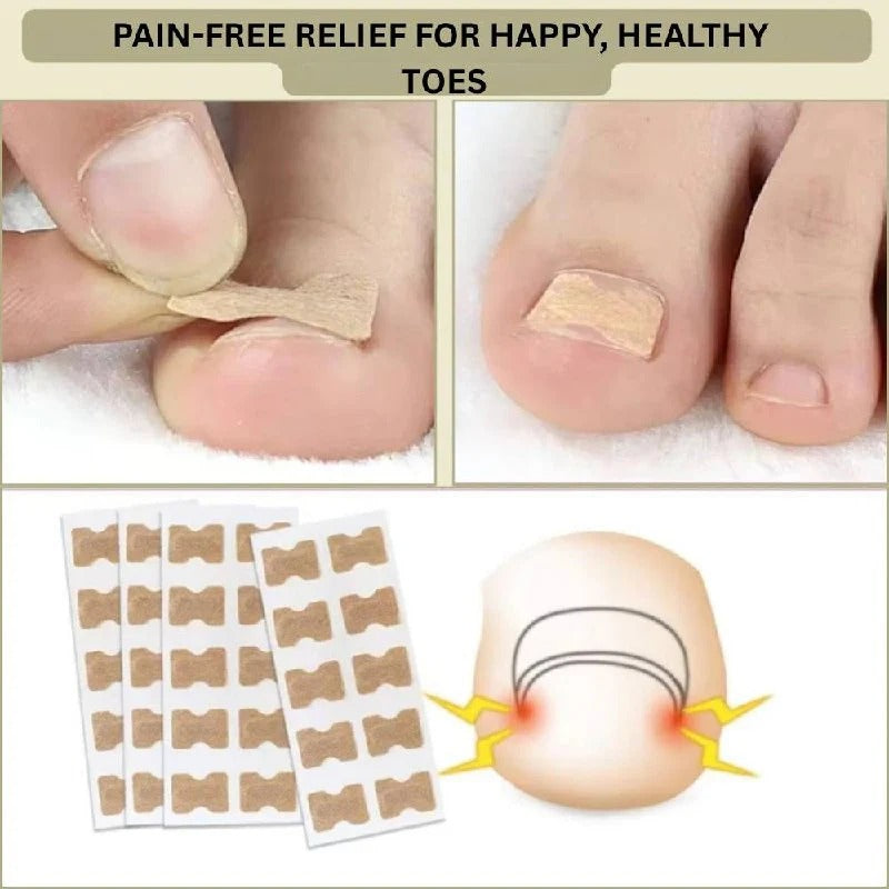 Adhesive toenail support strips for curved nails and daily care