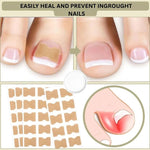 Adhesive toenail support strips for curved nails and daily care