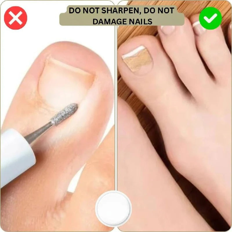 Adhesive toenail support strips for curved nails and daily care